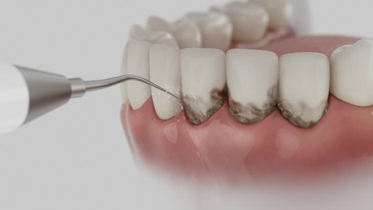 Reliable Dental contractor in Llano Grande, TX by Smile Center Dentistry